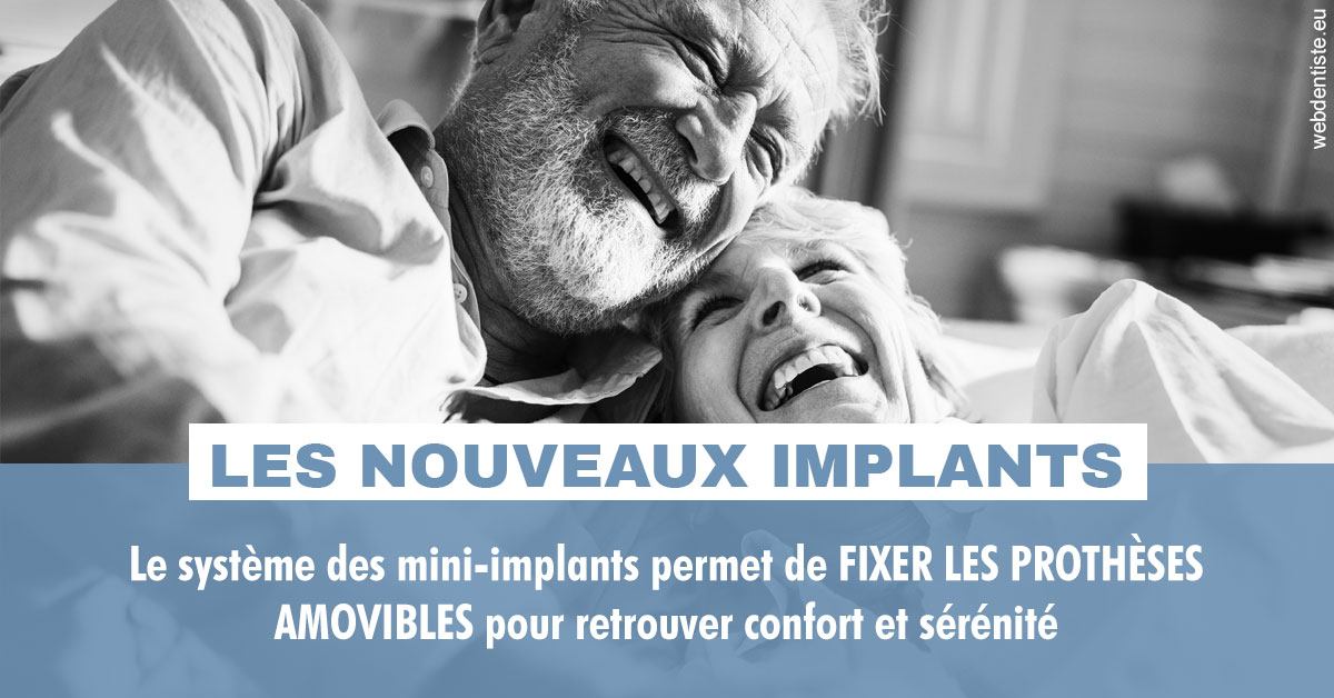 https://www.dr-quentel.fr/Les nouveaux implants 2
