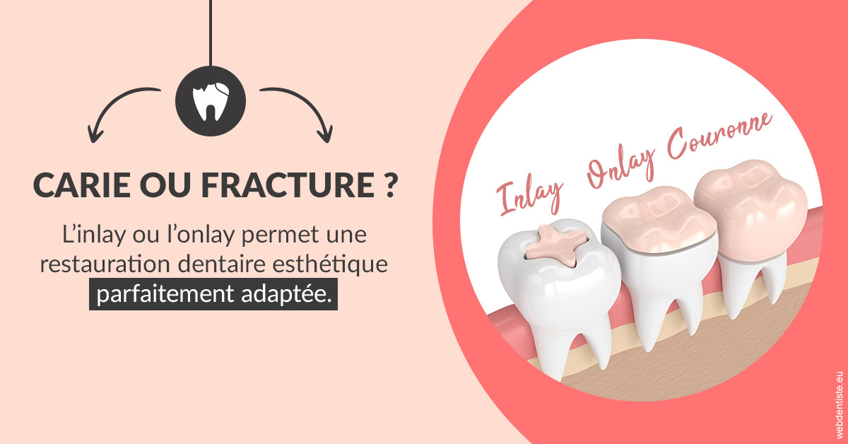 https://www.dr-quentel.fr/T2 2023 - Carie ou fracture 2