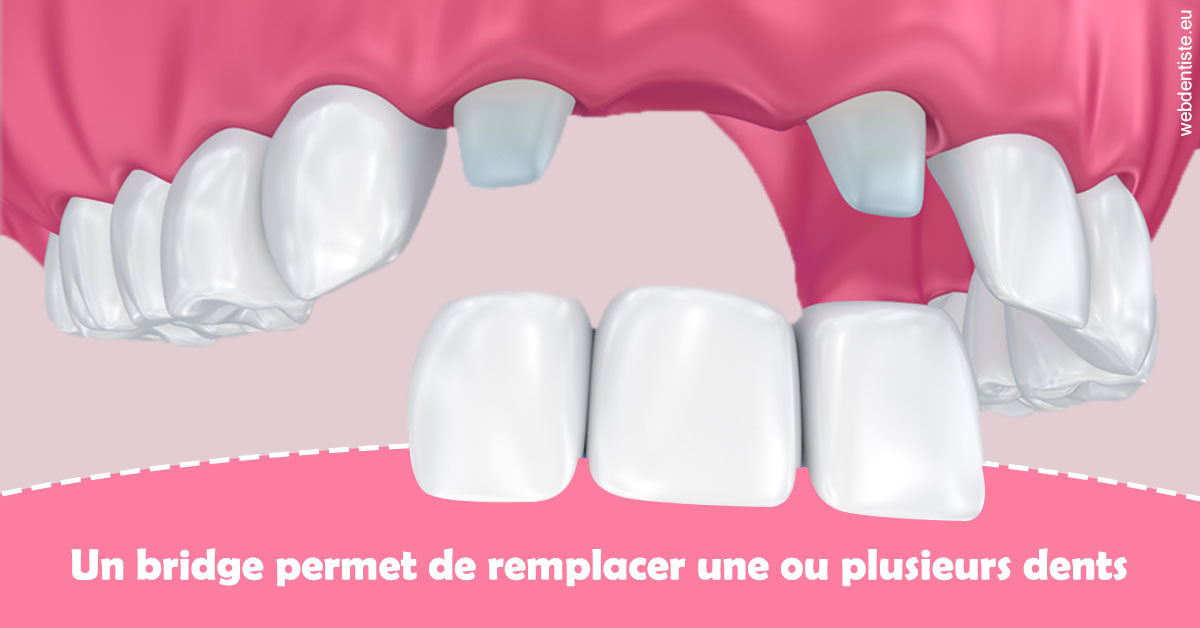 https://www.dr-quentel.fr/Bridge remplacer dents 2