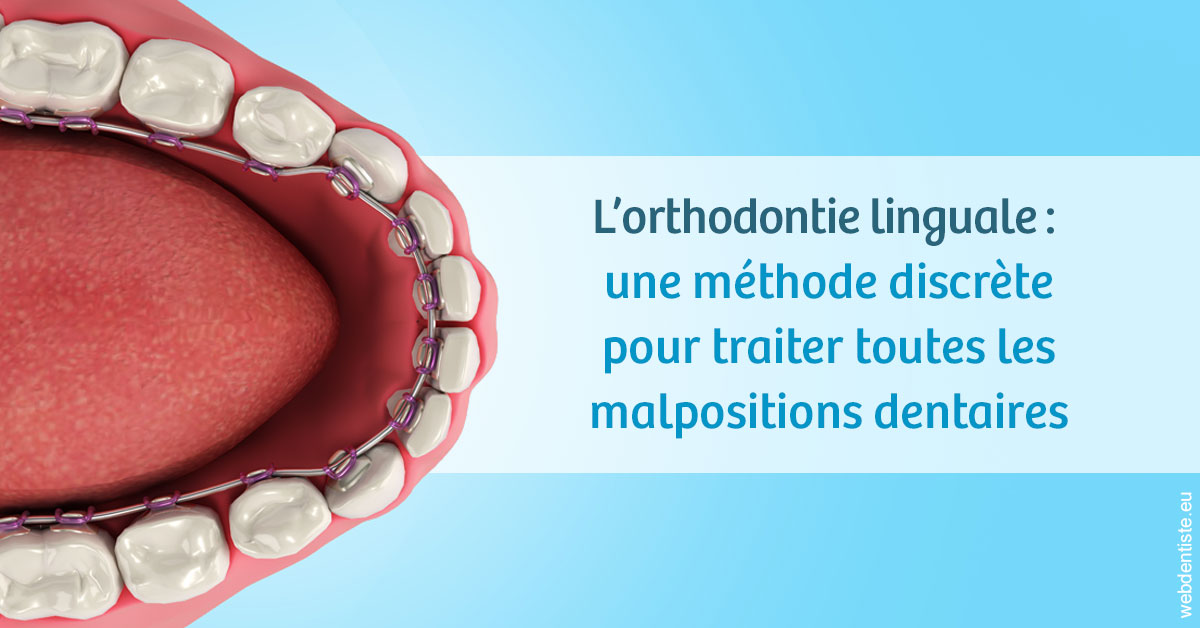https://www.dr-quentel.fr/L'orthodontie linguale 1