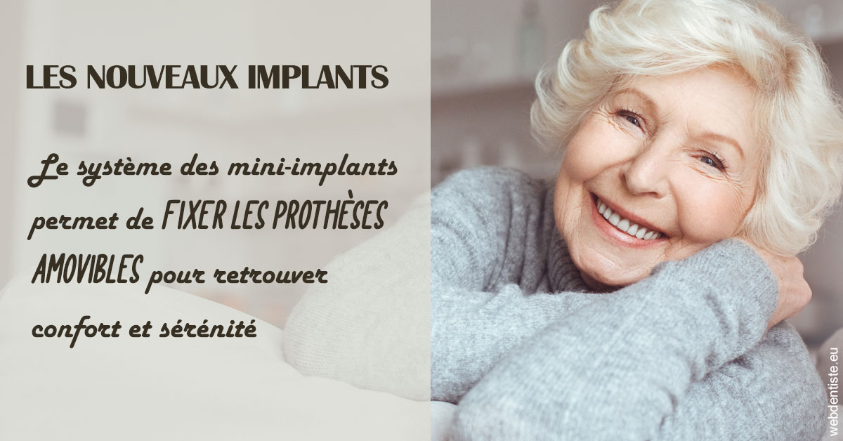 https://www.dr-quentel.fr/Les nouveaux implants 1