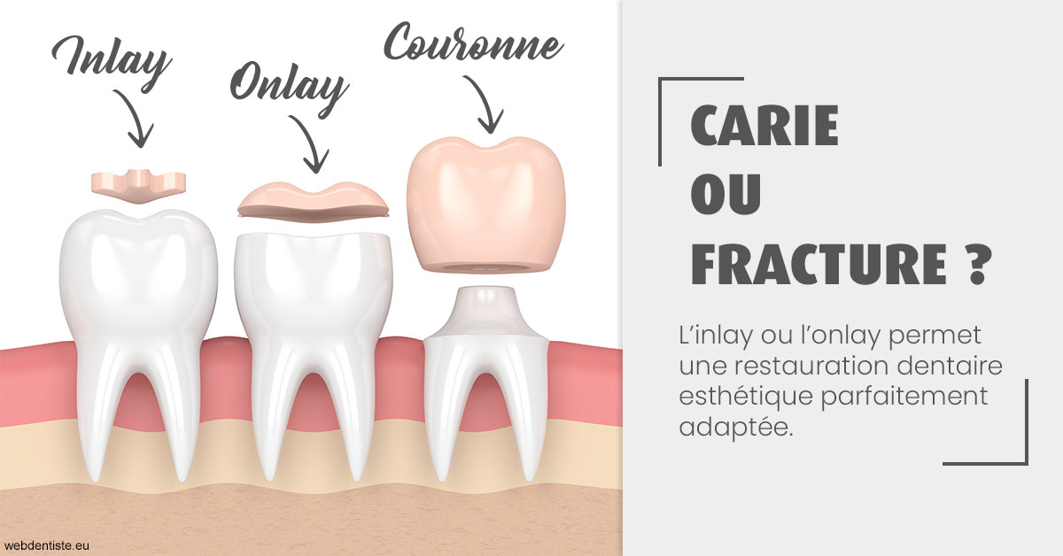 https://www.dr-quentel.fr/T2 2023 - Carie ou fracture 1