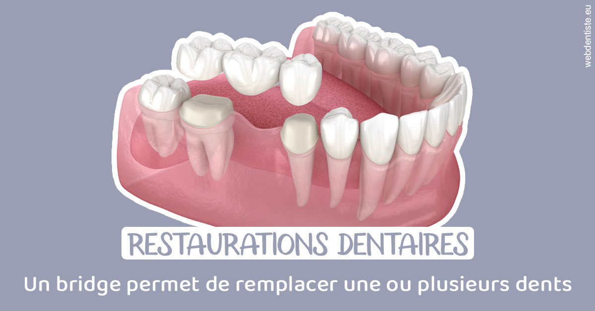 https://www.dr-quentel.fr/Bridge remplacer dents 1