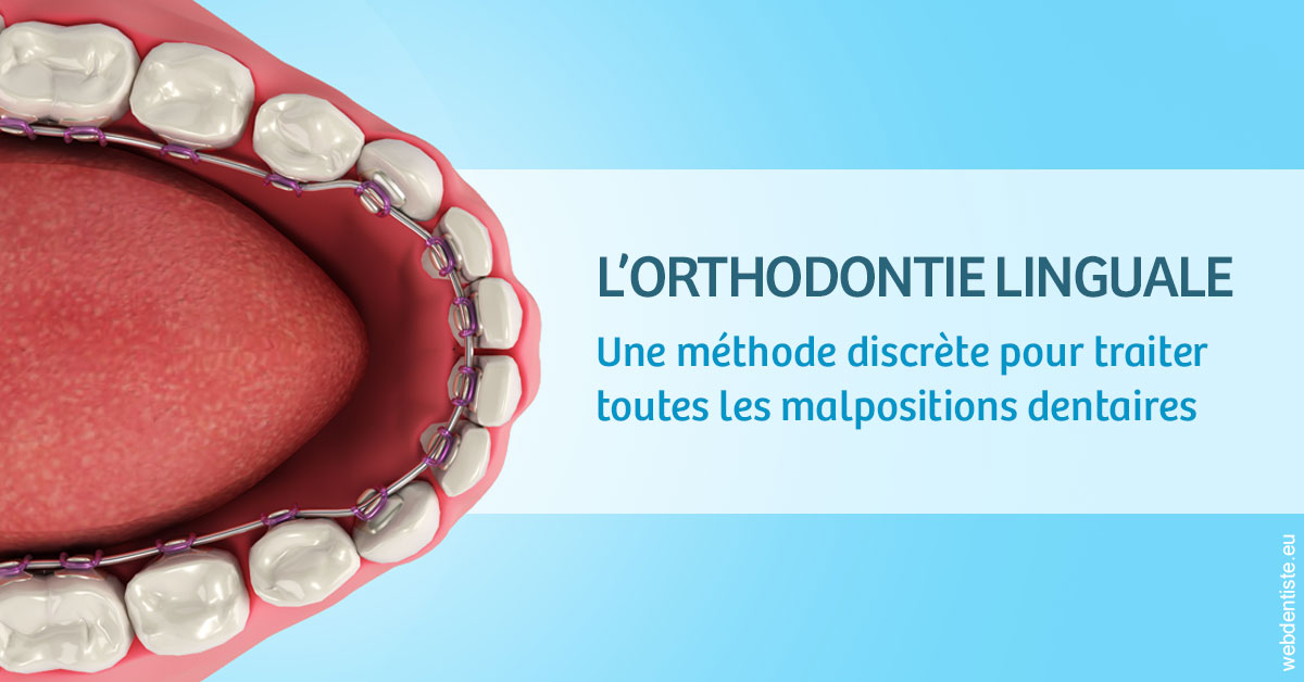 https://www.dr-quentel.fr/L'orthodontie linguale 1