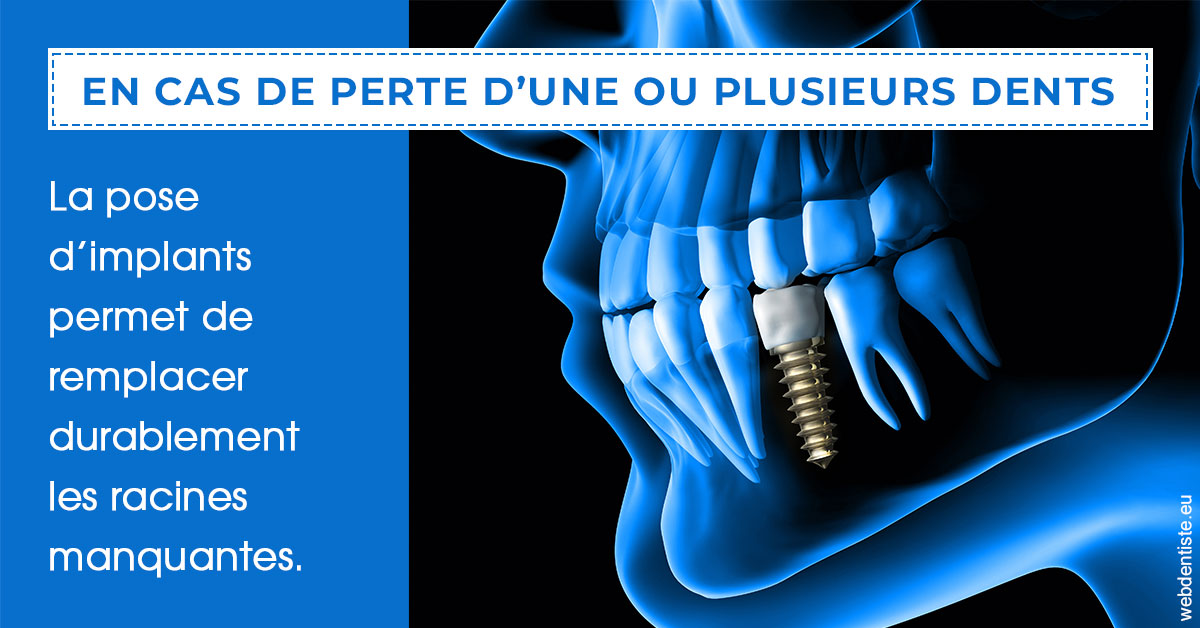 https://www.dr-quentel.fr/2024 T1 - Implants 01