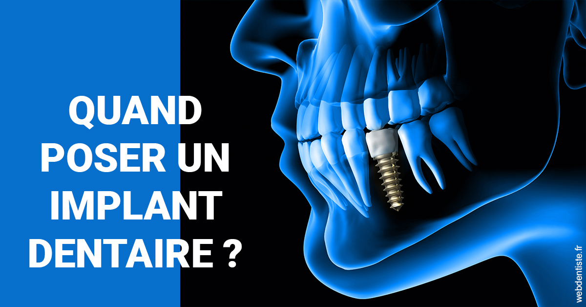https://www.dr-quentel.fr/Les implants 1