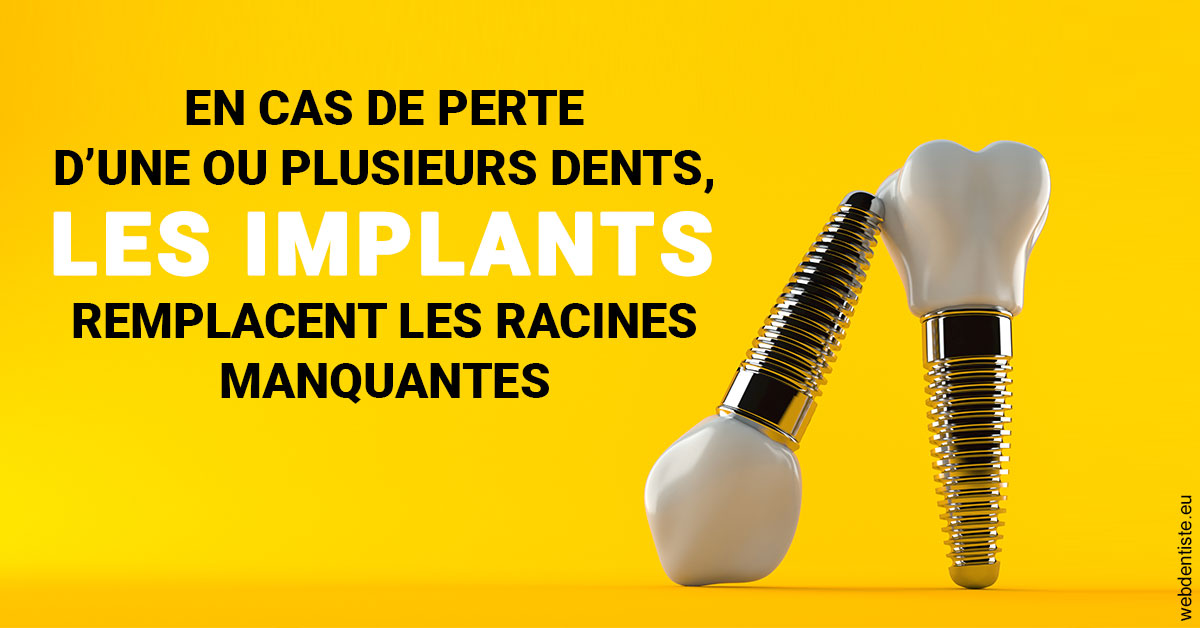 https://www.dr-quentel.fr/Les implants 2