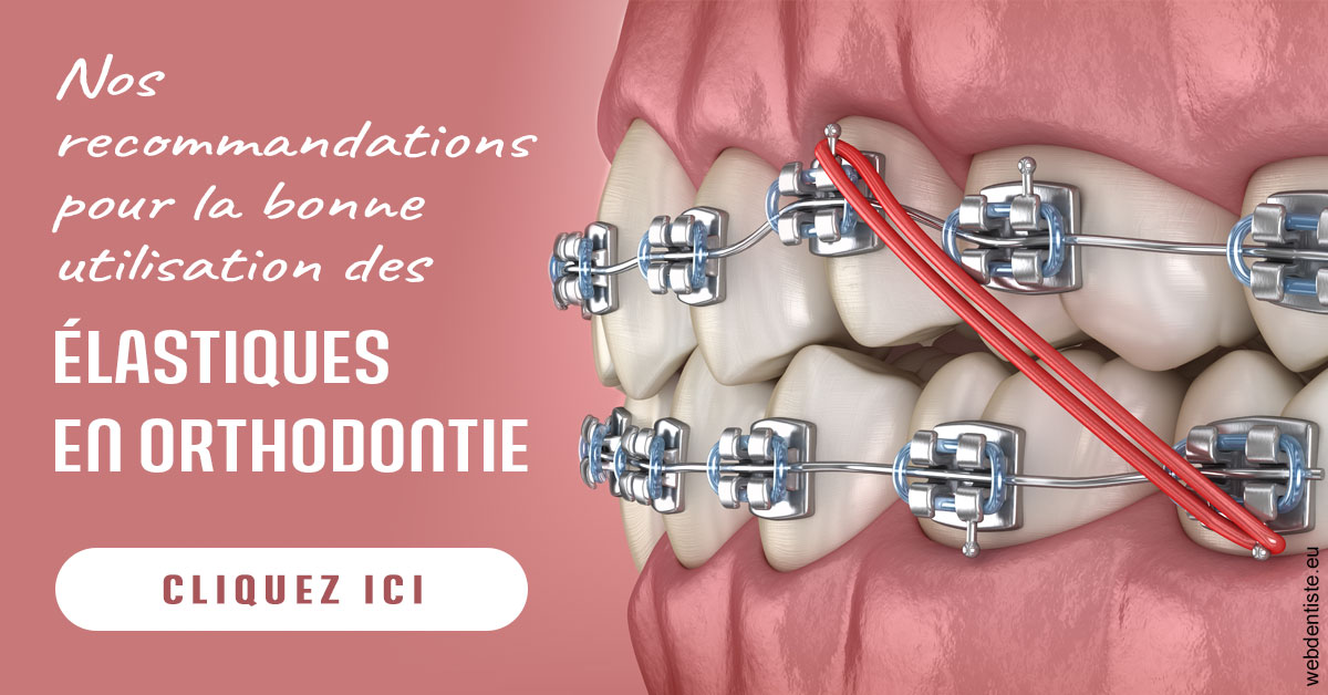 https://www.dr-quentel.fr/Elastiques orthodontie 2